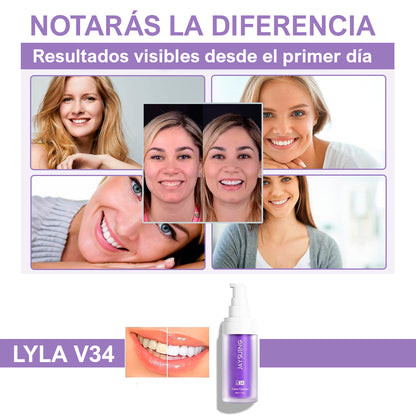 Blanqueador Dental Lyla V34  - ¡El Nuevo Método Que Hará Tu Sonrisa Más Blanca y Más Brillante!